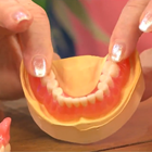 Example of dentures are displayed up close. 